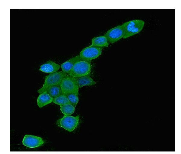 Anti-Rab5/RAB5A Antibody Picoband® (monoclonal, 3E9 Boster Bio