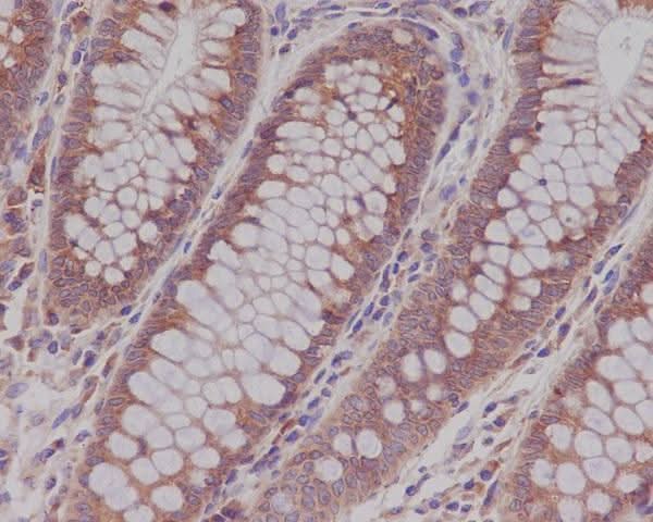 Anti-Rab5 RAB5A Rabbit Monoclonal Antibody Boster Bio