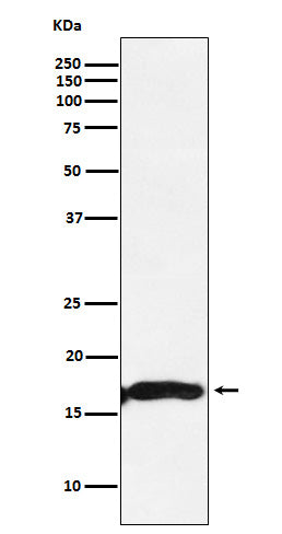 Anti-CRYAA Rabbit Monoclonal Antibody Boster Bio