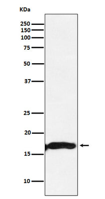 Anti-CRYAA Rabbit Monoclonal Antibody Boster Bio