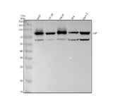 Anti-Catenin gamma JUP Rabbit Monoclonal Antibody Boster Bio