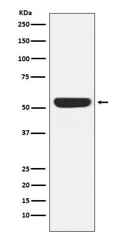 Anti-CAMKIV Rabbit Monoclonal Antibody Boster Bio
