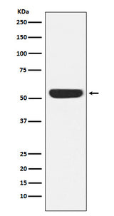 Anti-CAMKIV Rabbit Monoclonal Antibody Boster Bio