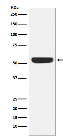 Anti-CAMKIV Rabbit Monoclonal Antibody Boster Bio