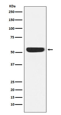 Anti-CAMKIV Rabbit Monoclonal Antibody Boster Bio