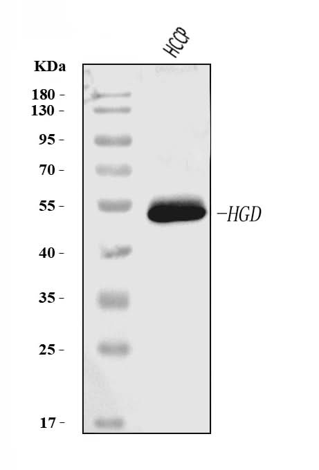 Anti-HGD Antibody Picoband® (monoclonal, 2F11E1 Boster Bio