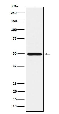 Anti-HGD Rabbit Monoclonal Antibody Boster Bio
