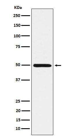 Anti-HGD Rabbit Monoclonal Antibody Boster Bio