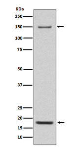 Anti-Integrin alpha 5 ITGA5 Rabbit Monoclonal Antibody Boster Bio