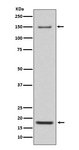 Anti-Integrin alpha 5 ITGA5 Rabbit Monoclonal Antibody Boster Bio