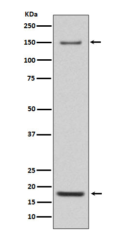 Anti-Integrin alpha 5 ITGA5 Rabbit Monoclonal Antibody Boster Bio