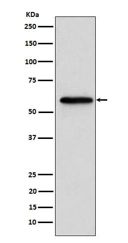 Anti-Retinoic Acid Receptor beta RARB Monoclonal Antibody Boster Bio