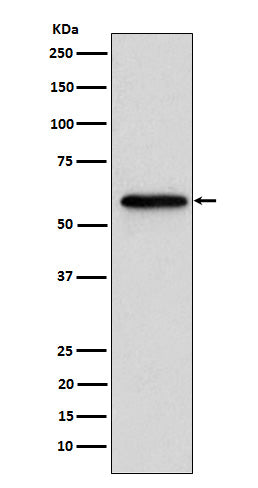 Anti-Retinoic Acid Receptor beta RARB Monoclonal Antibody Boster Bio