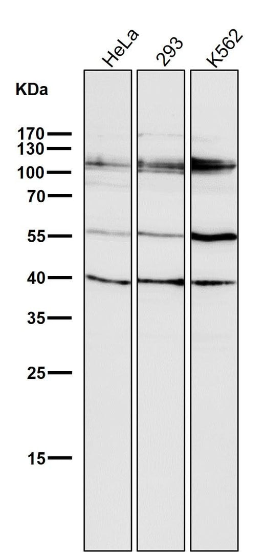 Anti-HDAC7/Histone Deacetylase 7 Rabbit Monoclonal Antibody Boster Bio