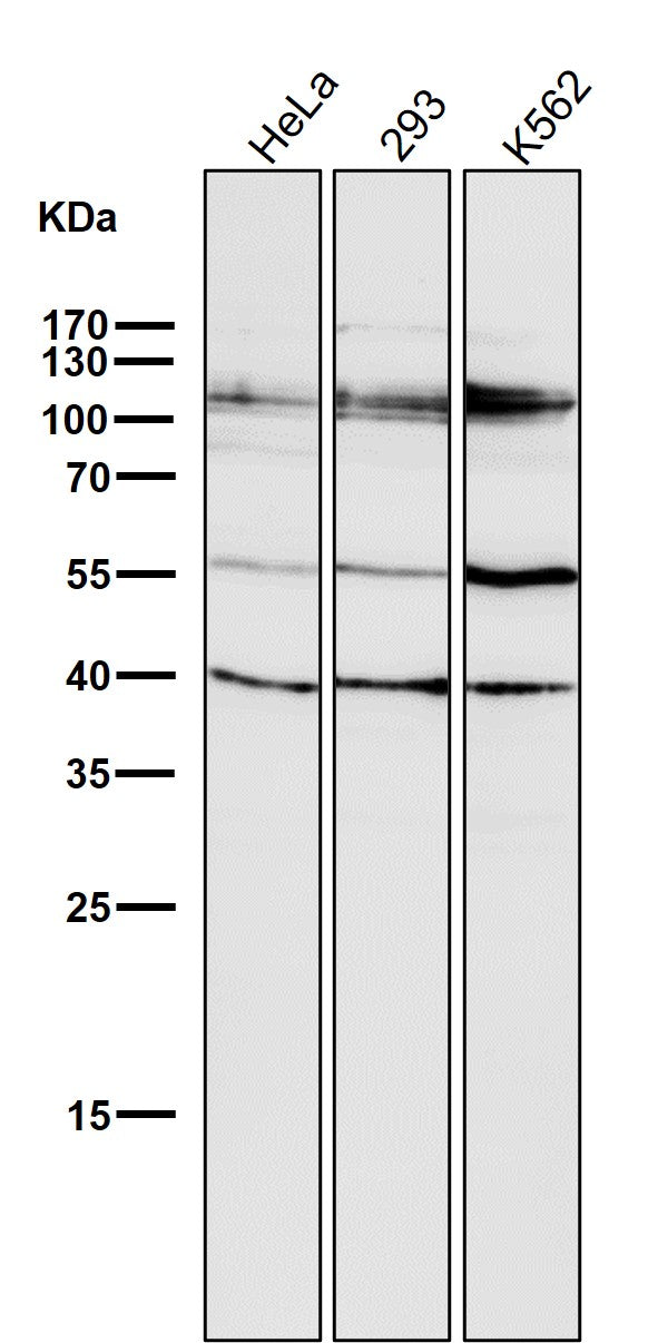 Anti-HDAC7/Histone Deacetylase 7 Rabbit Monoclonal Antibody Boster Bio