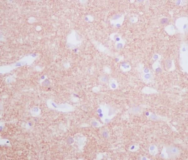 Anti-Tyrosine Hydroxylase TH Rabbit Monoclonal Antibody Boster Bio
