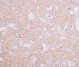 Anti-Tyrosine Hydroxylase TH Rabbit Monoclonal Antibody Boster Bio