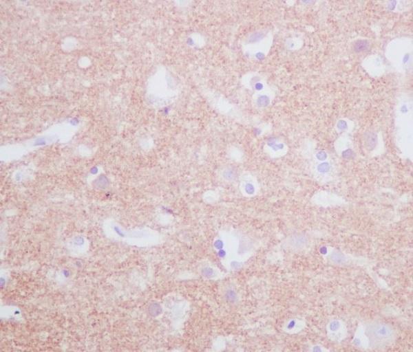 Anti-Tyrosine Hydroxylase TH Rabbit Monoclonal Antibody Boster Bio