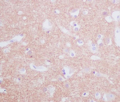 Anti-Tyrosine Hydroxylase TH Rabbit Monoclonal Antibody Boster Bio
