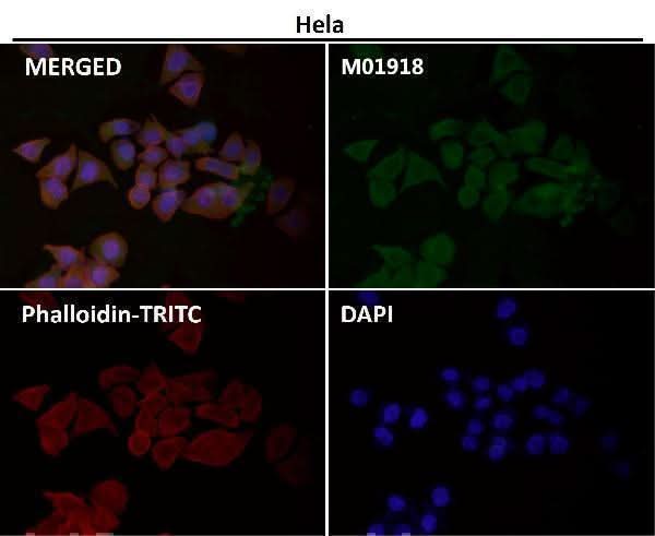 Anti-IKK alpha+beta CHUK Rabbit Monoclonal Antibody Boster Bio