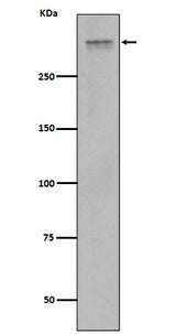 Anti-Plectin Rabbit Monoclonal Antibody Boster Bio