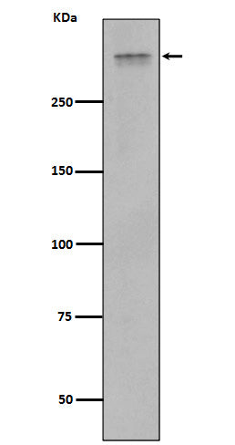 Anti-Plectin Rabbit Monoclonal Antibody Boster Bio