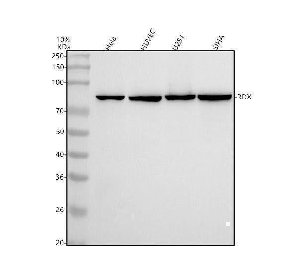 Anti-Radixin Rabbit Monoclonal Antibody Boster Bio