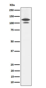 Anti-RASA1 Rabbit Monoclonal Antibody Boster Bio