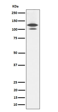 Anti-RASA1 Rabbit Monoclonal Antibody Boster Bio