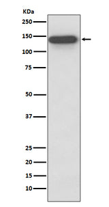 Anti-SMC3 Rabbit Monoclonal Antibody Boster Bio