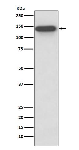 Anti-SMC3 Rabbit Monoclonal Antibody Boster Bio