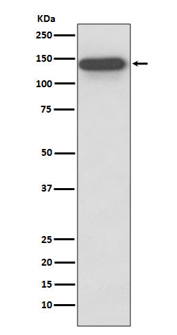 Anti-SMC3 Rabbit Monoclonal Antibody Boster Bio