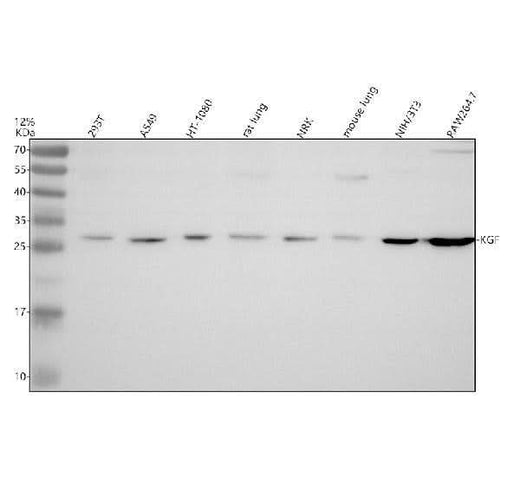Anti-KGF Rabbit Monoclonal Antibody Boster Bio