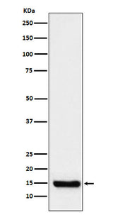 Anti-TTC11 Rabbit Monoclonal Antibody Boster Bio