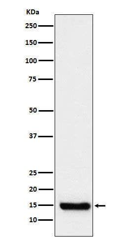 Anti-TTC11 Rabbit Monoclonal Antibody Boster Bio