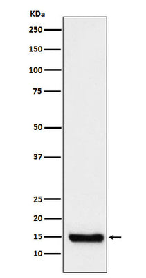 Anti-TTC11 Rabbit Monoclonal Antibody Boster Bio