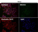 Anti-Integrin alpha 2 ITGA2 Rabbit Monoclonal Antibody Boster Bio