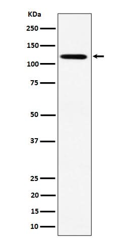 Anti-KIF5B Rabbit Monoclonal Antibody Boster Bio