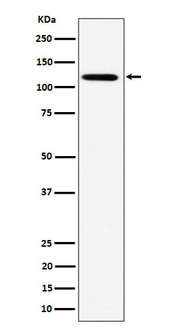 Anti-KIF5B Rabbit Monoclonal Antibody Boster Bio