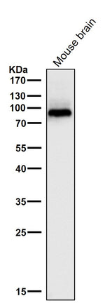 Anti-PKC beta 1 Rabbit Monoclonal Antibody Boster Bio