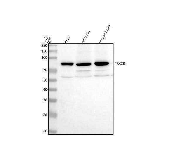 Anti-PKC beta 2 PRKCB Rabbit Monoclonal Antibody Boster Bio