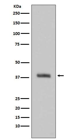 Anti-HTRA2/Omi Rabbit Monoclonal Antibody Boster Bio