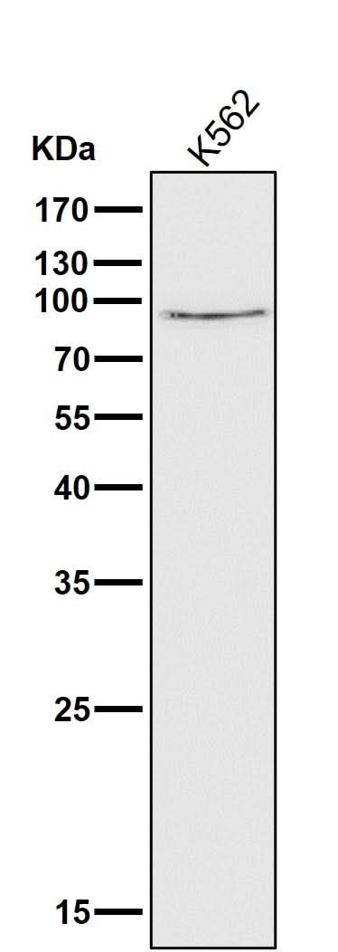 Anti-Calpain 1 CAPN1 Rabbit Monoclonal Antibody Boster Bio