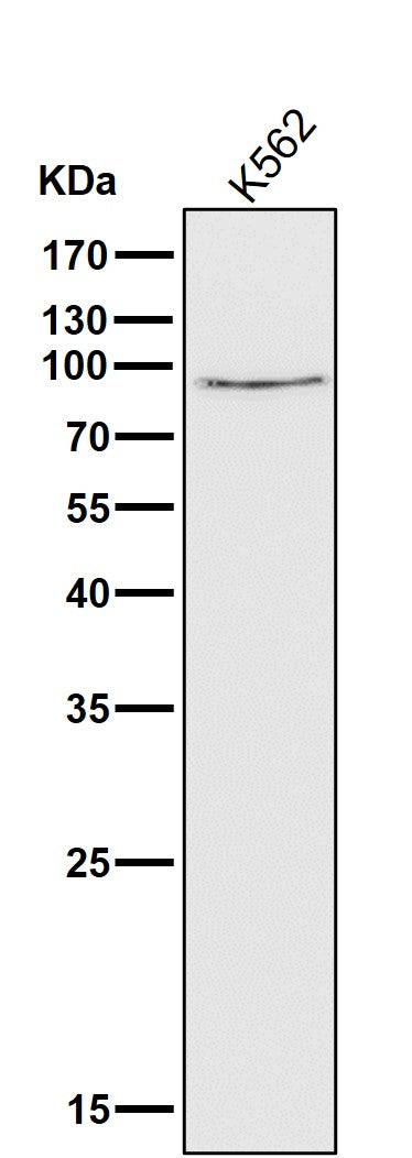 Anti-Calpain 1 CAPN1 Rabbit Monoclonal Antibody Boster Bio