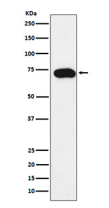 Anti-SLC22A1 Rabbit Monoclonal Antibody Boster Bio