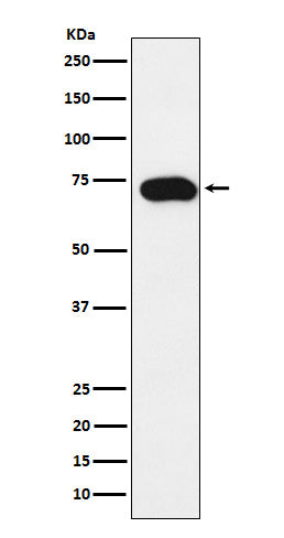 Anti-SLC22A1 Rabbit Monoclonal Antibody Boster Bio