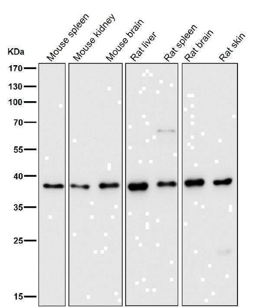 Anti-DNA Polymerase beta Monoclonal Antibody Boster Bio