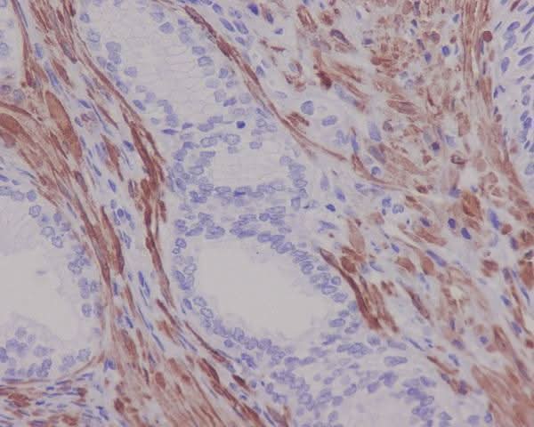 Anti-Desmin Rabbit Monoclonal Antibody Boster Bio