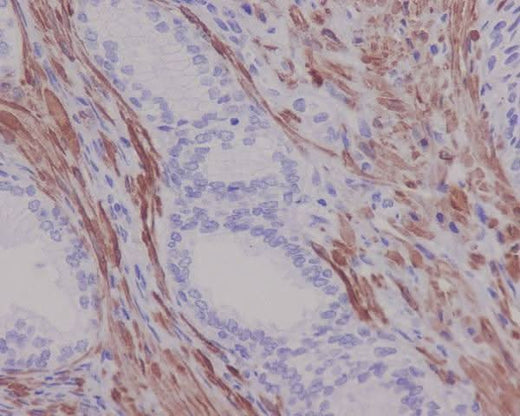 Anti-Desmin Rabbit Monoclonal Antibody Boster Bio