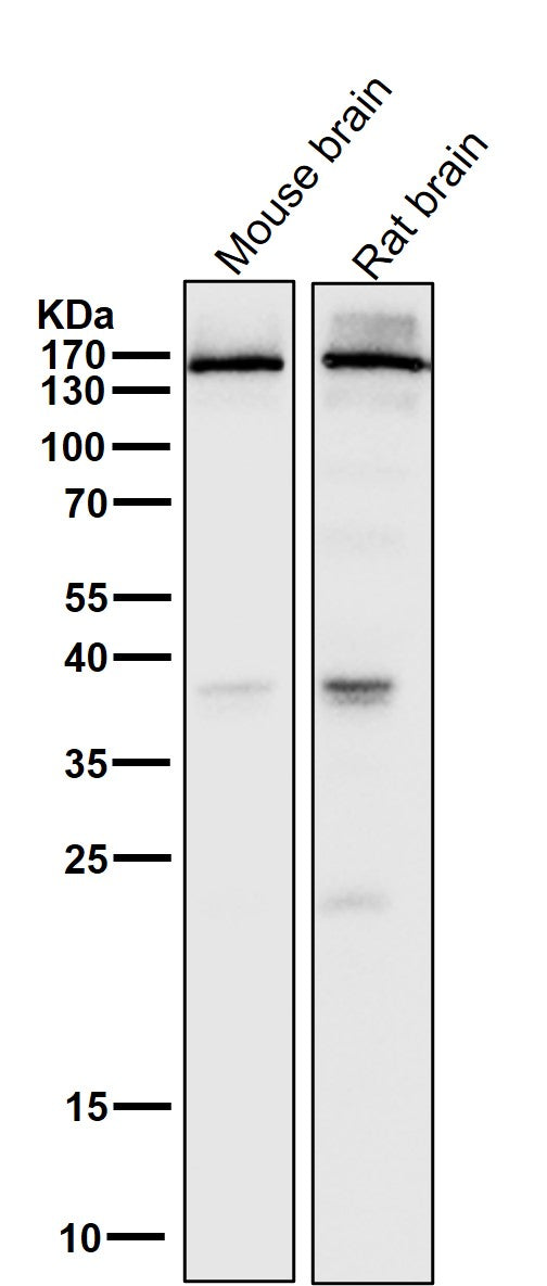 Anti-NMDAR2A Rabbit Monoclonal Antibody Boster Bio